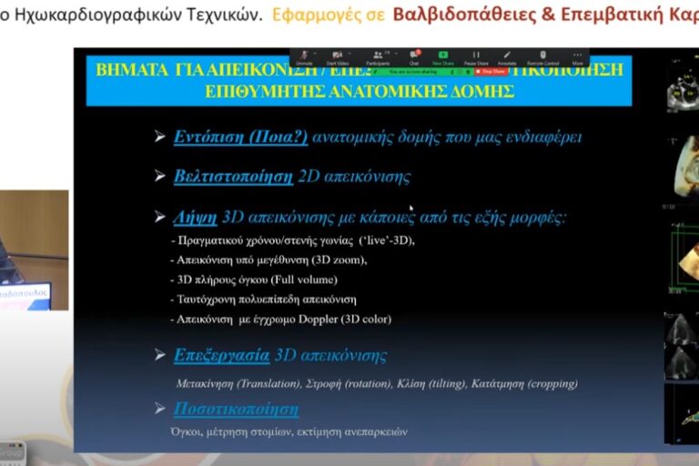 Βασικές αρχές τριδιάστατης Ηχωκαρδιογραφίας