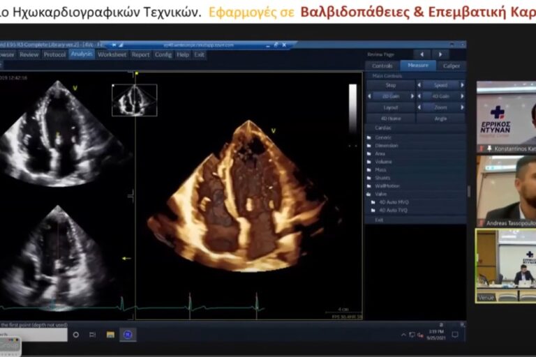 Τριδιάστατη Απεικόνιση Μεσοκολπικού Διαφράγματος Και Ωτίου Αριστερού Κόλπου