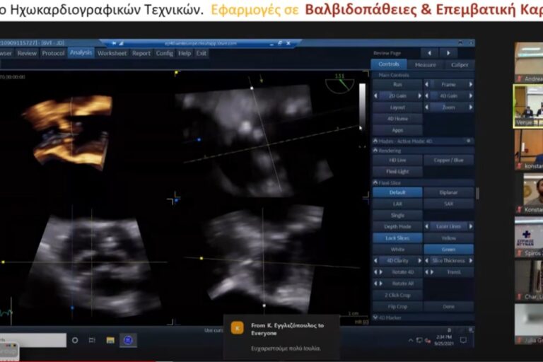 Τριδιάστατη απεικόνιση και εκτίμηση αορτικής βαλβίδας και αορτής