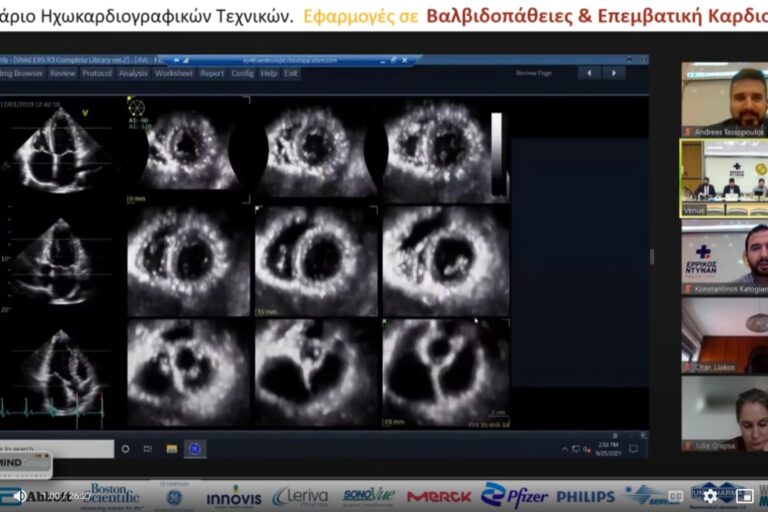Τριδιάστατη απεικόνιση και εκτίμηση τριγλώχινας και πνευμονικής βαλβίδας